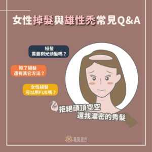 女性植髮常見問題FAQ